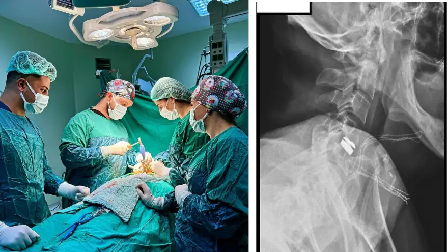 Doğubayazıt'ta Mikrocerrahi ile Boyun Fıtığı Ameliyatı İlk Kez Başarıyla Gerçekleştirildi!