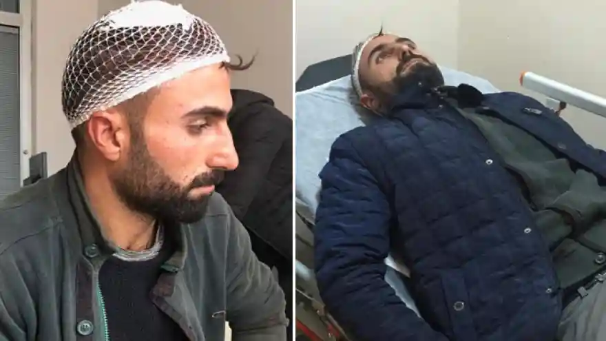 Aras'ın Personeline Keserle Saldırdılar
