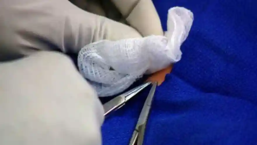 İtalya'da evde sünnet edilen bir bebek öldü, ikizi ağır yaralandı
