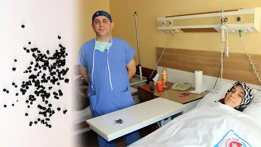 Safra Kesesinden 200 Taş Çıkarıldı
