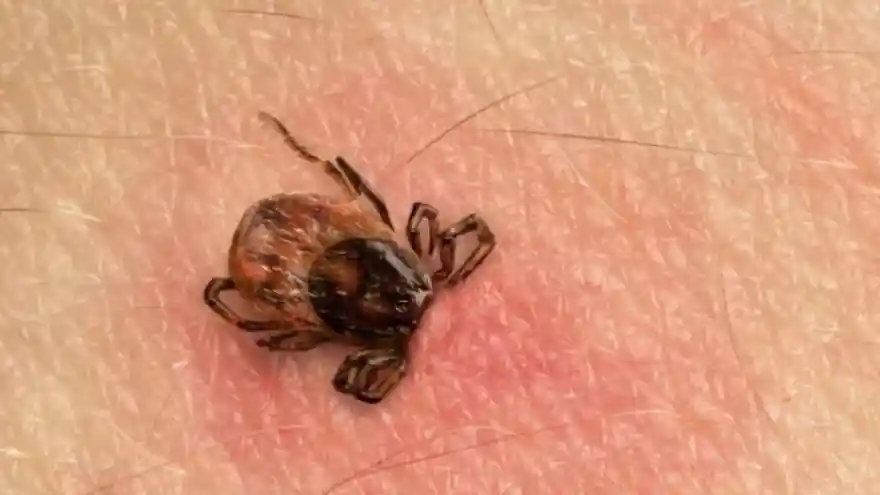 Türkiye'de KKKA vaka sayısı 492'ye ulaştı, 18 kişi hayatını kaybetti