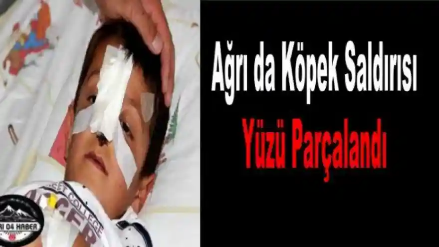 Ağrı da Köpeklerin Saldırdığı Çocuk Ölümden Döndü  