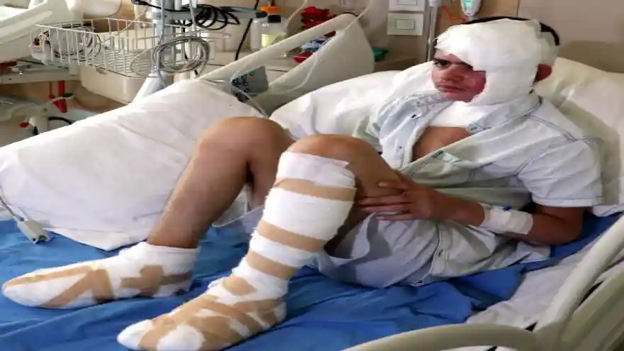 Elektrik akımına kapılan Ebubekir'in ayak tabanları patladı