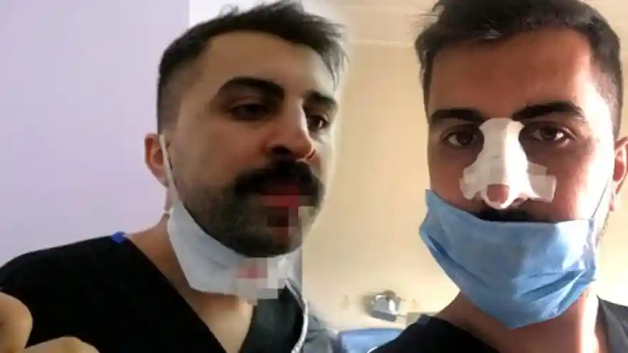 Sağlık çalışanlarına şiddet bitmiyor! Hasta yakını, sosyal mesafe uyarısı yapan hemşirenin burnunu k