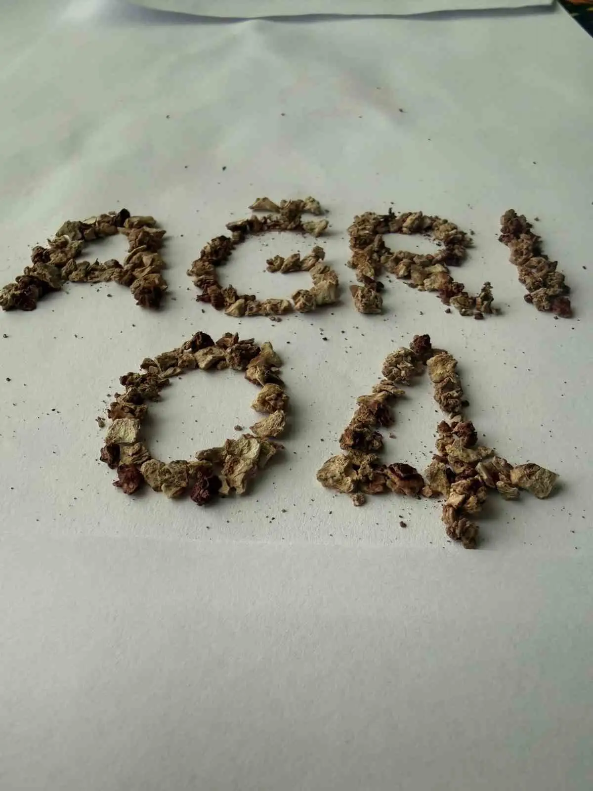 Ağrı’da zorlu taş cerrahisi başarıyla gerçekleştirildi 